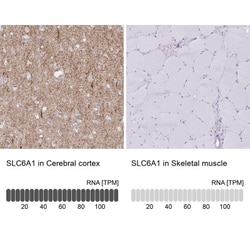 GAT-1/SLC6A1 Antibody, Novus Biologicals:Antibodies:Primary Antibodies